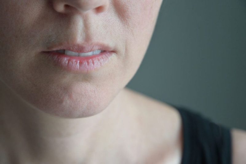 Štai, ką apie jūsų sveikatą byloja veido spalva. Papilkėjęs veidas