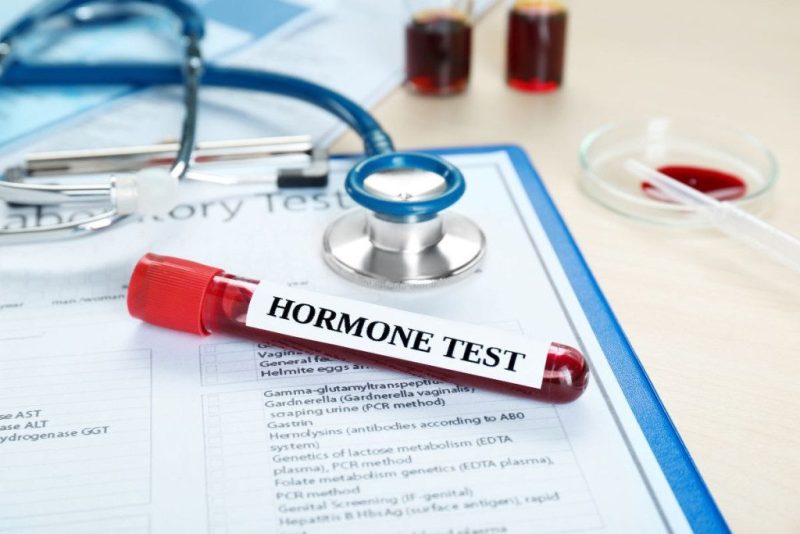 Kaip atpažinti padidėjusį lytinius hormonus sujungiančio globulino kiekį?