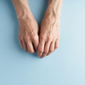 Gerai matomos melsvos venos. Štai, ką tai sako. Būklė, susijusi su patologiniais veiksniais