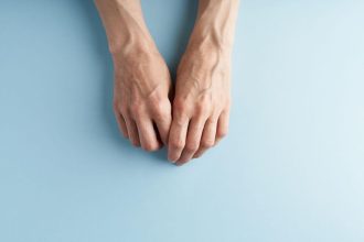Gerai matomos melsvos venos. Štai, ką tai sako. Būklė, susijusi su patologiniais veiksniais