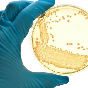 Ši bakterija – mirtinas iššūkis medicinai