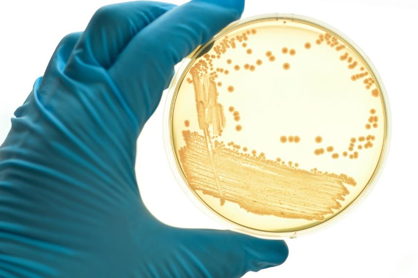 Ši bakterija – mirtinas iššūkis medicinai