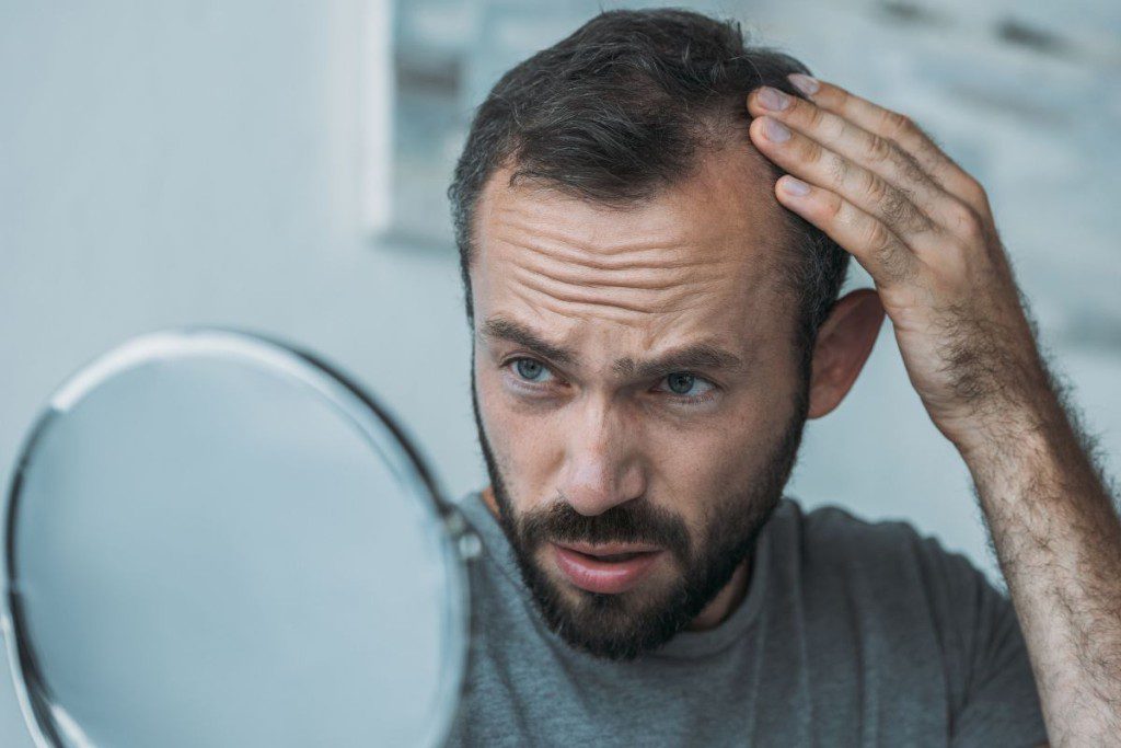 Hormonai lemiantys plaukų slinkimą