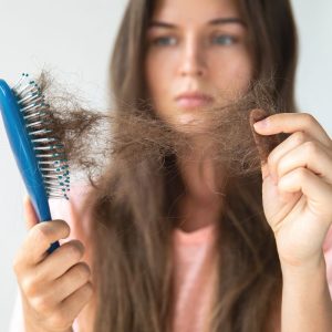 Hormonai ir paveldimumas: kaip jie veikia plaukų slinkimą?