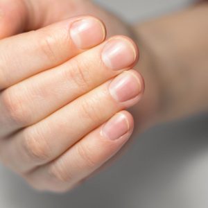 Maistas stipriems ir sveikiems nagams: bus tvirti ir gražūs