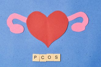 Maisto papildai, padedantys valdyti policistinių kiaušidžių sindroma