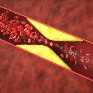 Cholesterolį padeda sumažinti baltymas, esantis migdolų riešutuose. Geresnis cholesterolio reguliavimas