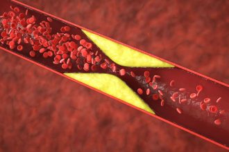 Cholesterolį padeda sumažinti baltymas, esantis migdolų riešutuose. Geresnis cholesterolio reguliavimas
