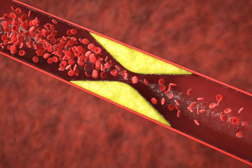 Cholesterolį padeda sumažinti baltymas, esantis migdolų riešutuose. Geresnis cholesterolio reguliavimas