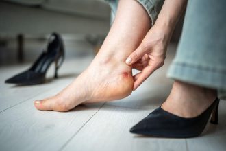 Kulnų trintis - būdai išvengti nepatogumo