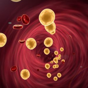 Naujas tyrimas atskleidžia ryšį tarp cholesterolio ir demencijos rizikos