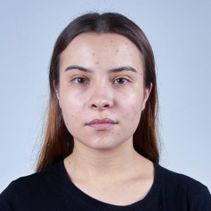 Turite riebią odą? 7 dalykai, kuriuos turėtumėte nustoti daryti