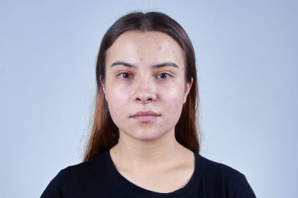 Turite riebią odą? 7 dalykai, kuriuos turėtumėte nustoti daryti