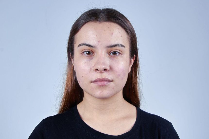 Turite riebią odą? 7 dalykai, kuriuos turėtumėte nustoti daryti
