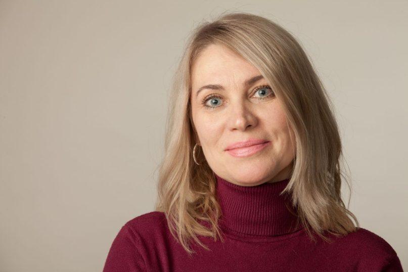 50+ odos priežiūra: štai kokį stebuklą jūsų odai gali padaryti peptidai