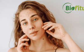 Kaip pagerinti odos elastingumą ir išvaizdą? Biofitus patarimai