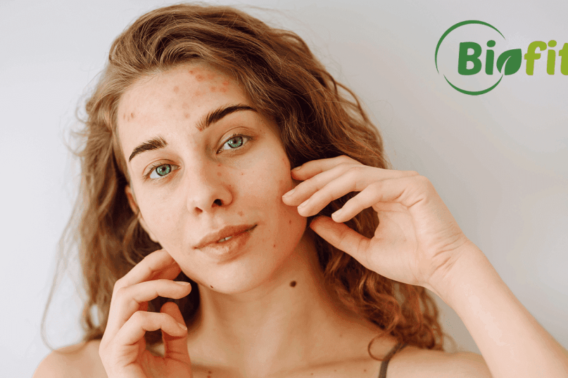 Kaip pagerinti odos elastingumą ir išvaizdą? Biofitus patarimai