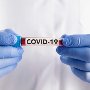 Naujoji COVID-19 atmaina XFG: ar yra pagrindo nerimauti?