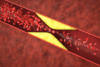 Obuoliai – natūrali pagalba mažinant cholesterolio kiekį