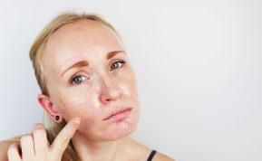 Riebios odos priežiūra: dermatologų patarimai ir gudrybės