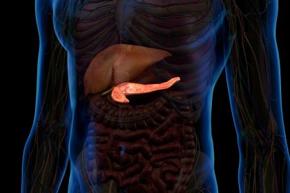 Gastroenterologas įvardino pavojingą produktų derinį: tai labai kenkia kasai