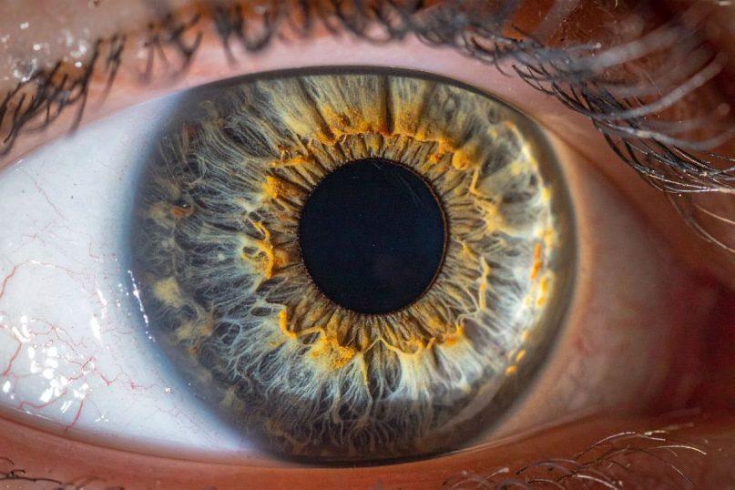 Ką besikeičiantis vyzdžių dydis sako apie jūsų sveikatą?