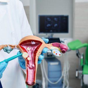 Kada ginekologą turėtų lankyti paauglės merginos?