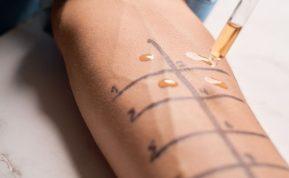 Kai maistas tampa priešu: histamino netoleravimas ir jo paslaptys