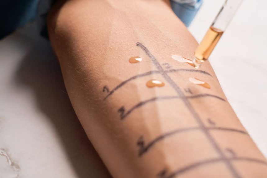 Kai maistas tampa priešu: histamino netoleravimas ir jo paslaptys