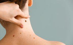 Kaip pagal apgamų vietą sužinoti žmogaus charakterį?