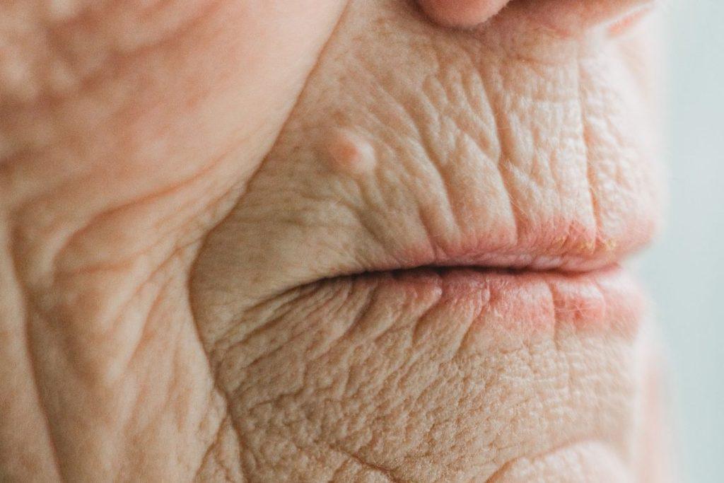 Asmenybės psichologija: ką raukšlės gali pasakyti apie žmogų ir jo charakterį? Raukšlės aplink burną