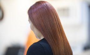 Plaukai auga kaip pašėlę ir neslenka