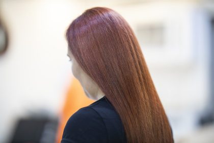 Plaukai auga kaip pašėlę ir neslenka