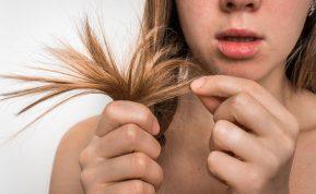 Kodėl jūsų plaukai skleidžia nemalonų kvapą: 5 priežastys