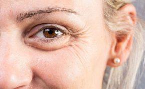 Norite sumažinti raukšles? Išbandykite žuvies taukų kaukę!