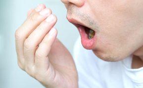 4 priežastys, kodėl atsiranda blogas burnos kvapas ir kaip jį pašalinti?