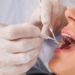 5 paprasti patarimai, kuriuos odontologai rekomenduoja savo draugams