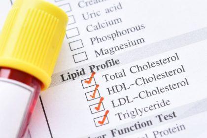 Kaip ir kada pradėti kontroliuoti cholesterolį: svarbi informacija apie jo tipus ir riziką