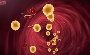 Medikai įvardino geriausius būdus, kaip sumažinti cholesterolio kiekį kraujyje nenaudojant vaistų