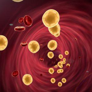 Medikai įvardino geriausius būdus, kaip sumažinti cholesterolio kiekį kraujyje nenaudojant vaistų