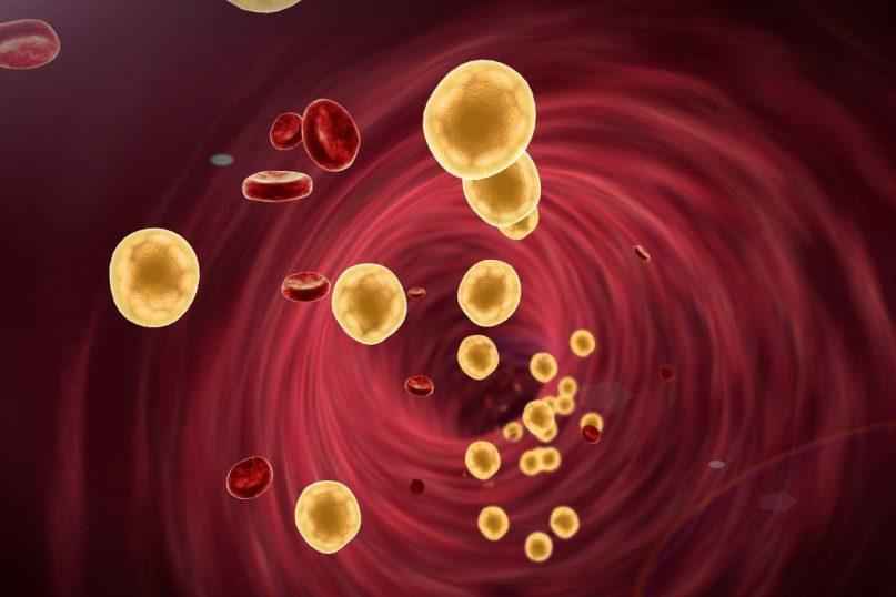 Medikai įvardino geriausius būdus, kaip sumažinti cholesterolio kiekį kraujyje nenaudojant vaistų