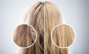 Plaukai taip pat sensta: kaip hormonai ir gimdos ligos daro įtaką plaukų sveikatai nuo 40 metų