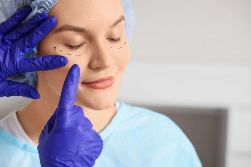 Štai ką vertėtų žinoti apie veido patempimo operaciją