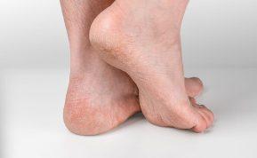 Priemonė, skirta atstatyti šiurkščius ir suskilinėjusius kulnus.