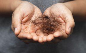 Veiksmingas būdas, kuris padės kovoti su plaukų slinkimu.