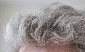 Žili plaukai gali būti kūno apsauga: ką atskleidė tyrimas