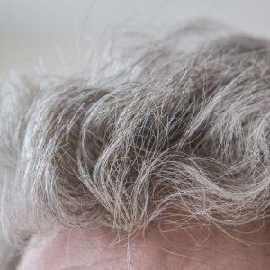 Žili plaukai gali būti kūno apsauga: ką atskleidė tyrimas