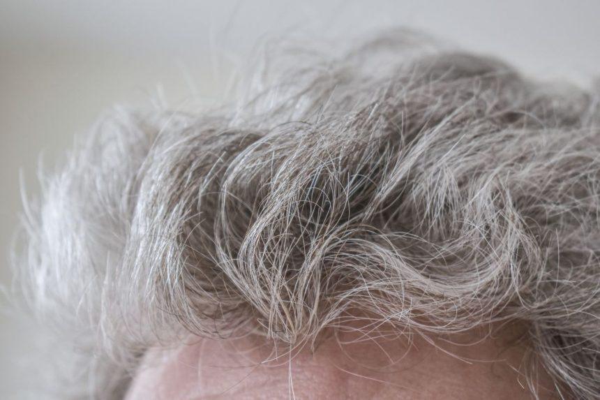 Žili plaukai gali būti kūno apsauga: ką atskleidė tyrimas