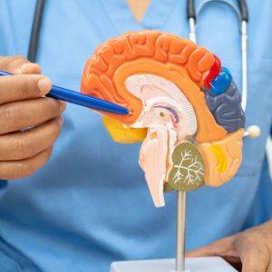 10 Alzheimerio ligos požymių. Laiku atpažinkite ligą!