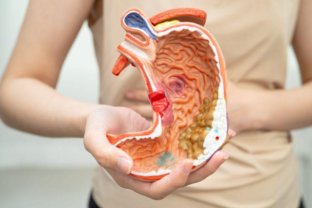 3 geros priežastys nustoti gulėti ant pilvo. Virškinimo problemos problemos